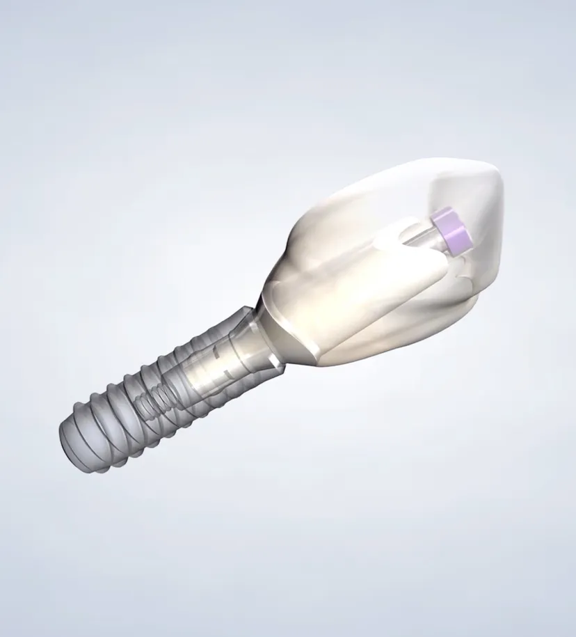 Procedure query page dental implants
